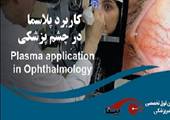 سمینار یکروزه کاربرد پلاسما در چشم پزشکی